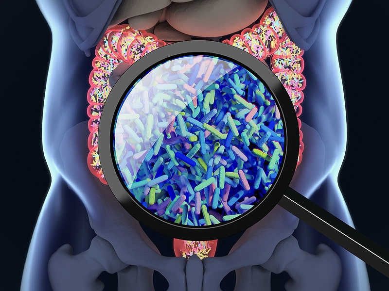 Gut Microbiome May Be Key Variable in Immunotherapy Efficacy