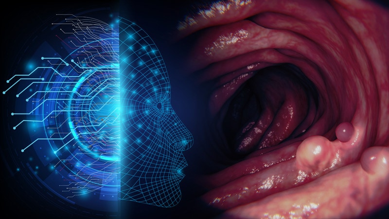 AI in GI: The Future of Diagnosing Disease in Gastroenterology