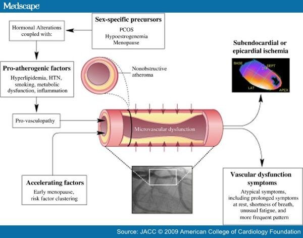 Women And Ischemic Heart Disease Evolving Knowledge