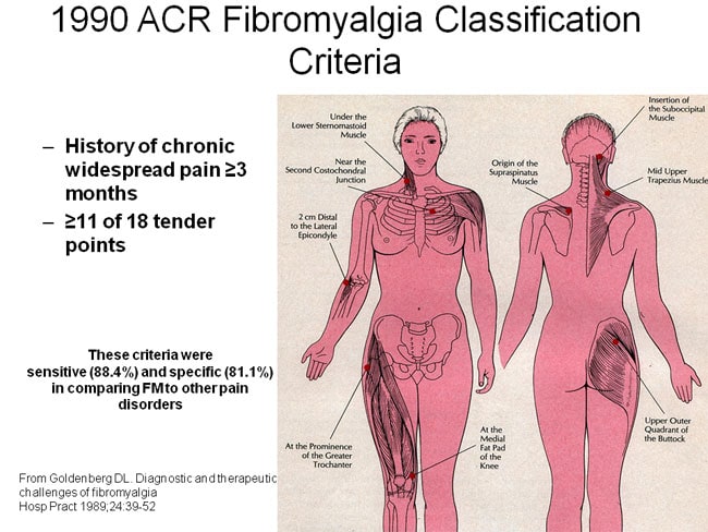 What are symptoms of fibromyalgia in women?