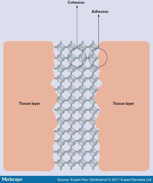 tisseel tissue glue for cracked