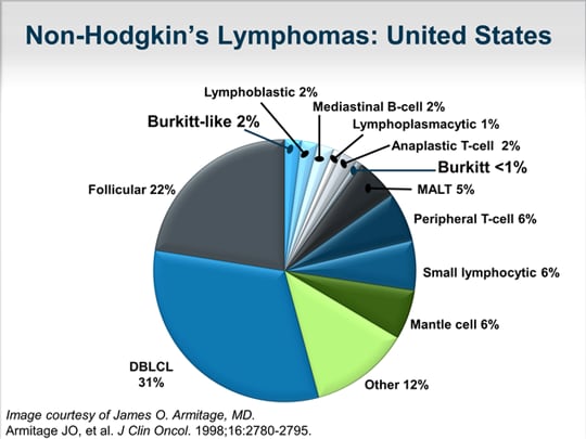 Diagnosis And Management Of Rare Lymphoma Subtypes Burkitt Lymphoma Transcript 5490