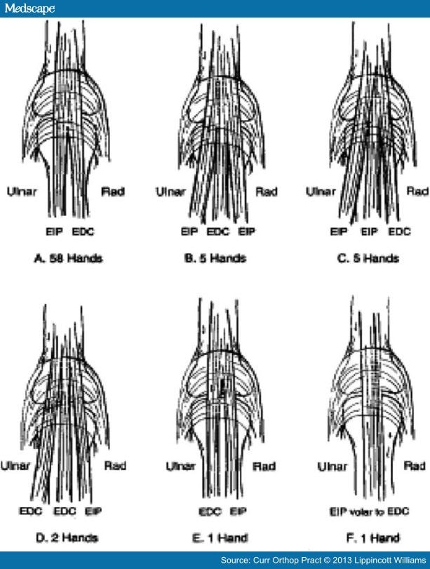 Extensors of the Hand