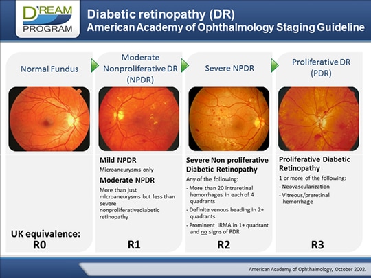 Current Challenges in Diabetic Retinopathy: Early Diagnosis and Ways to