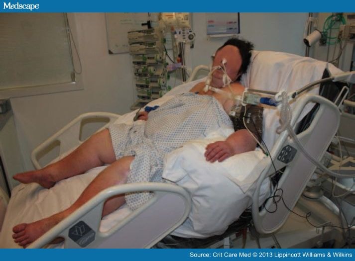 Position And Applied Peep In Critically Ill Obese Patients