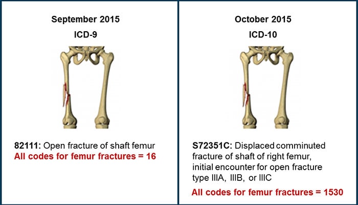 left supracondylar fracture icd 10