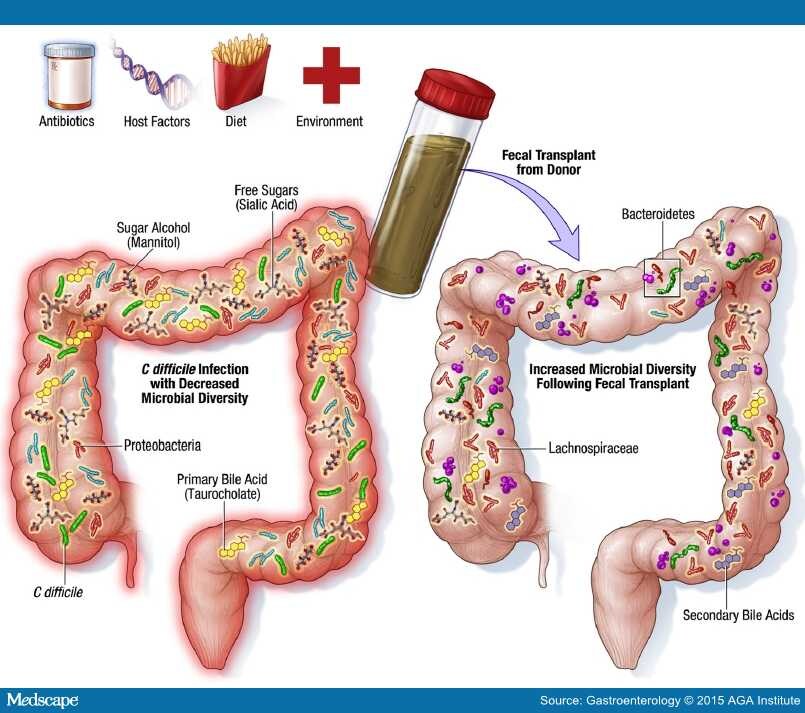 Kidney transplant graft survival fees dialysis tubing treatment