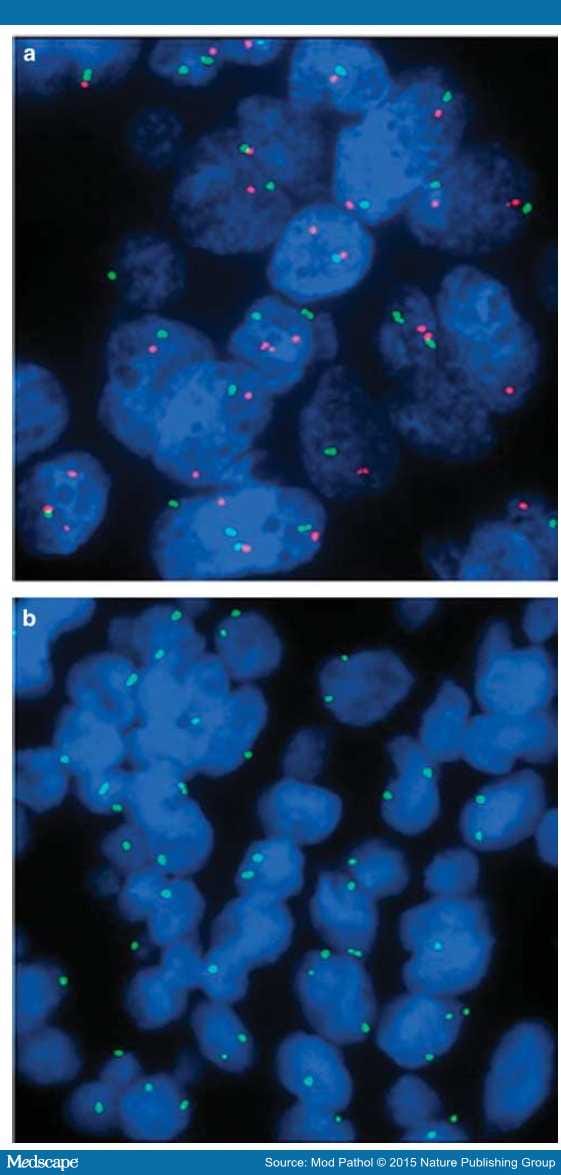 Is asbestos repayment taxable what's asbestos awareness training