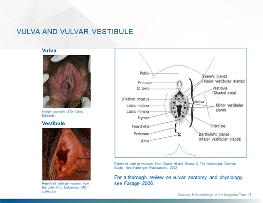 Vulvodynia: A Common and Under-Recognized Pain Disorder in Women and