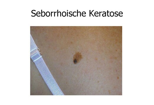 Slide 14.