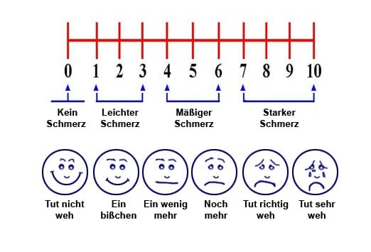 Wirksames Schmerzmanagement | Medscape