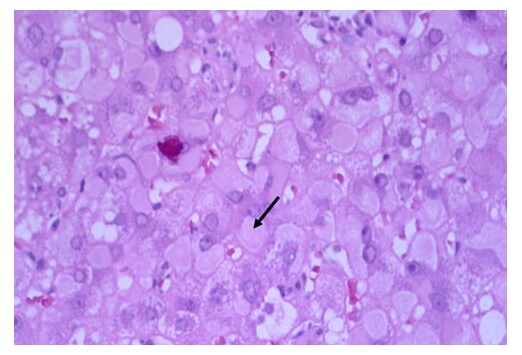 Slide 13.