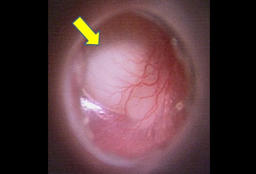 Slide 5.
