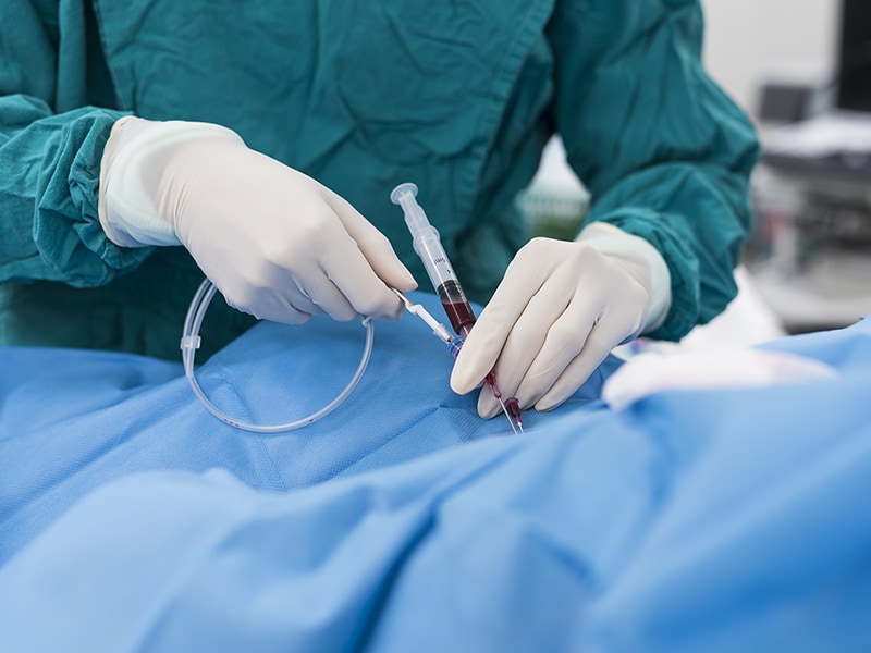 Mitralklappenvitium Kardioband und Stents per Katheter