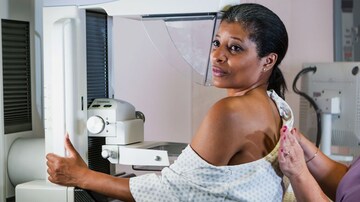Le dépistage du cancer du sein assisté par l'IA pourrait réduire la charge de travail des radiologues