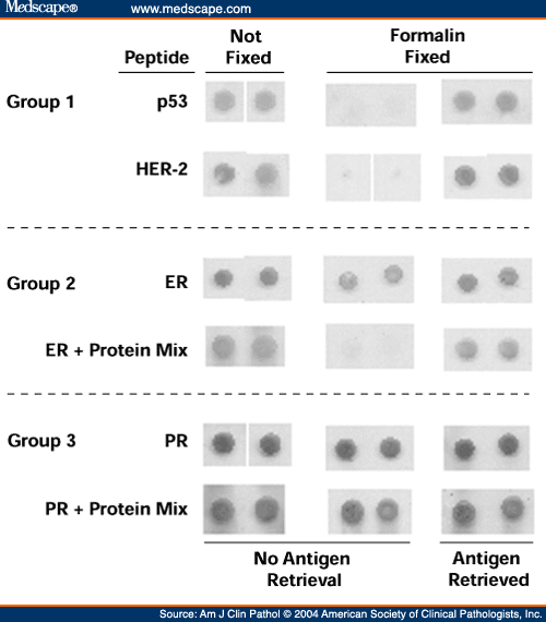 A Molecular Mechanism of Formalin Fixation and Antigen Retrieval