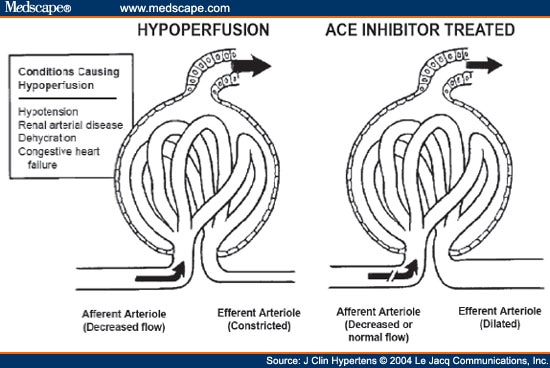 What are some common ACE inhibitors?
