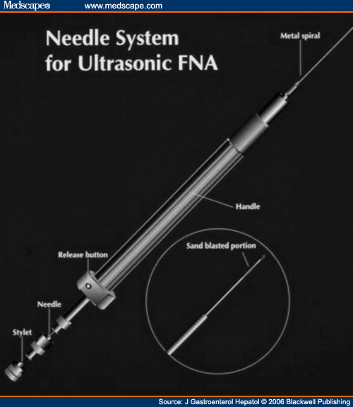 Endoscopic UltrasoundGuided Fine Needle Aspiration Biopsy