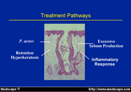 Primary Care Dermatology Roundtable: Common Dermatologic Primary Care Dermatology Roundtable: Common Dermatologic