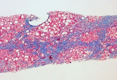 Nolvadex for sale gyno Nolvadex for sale gyno