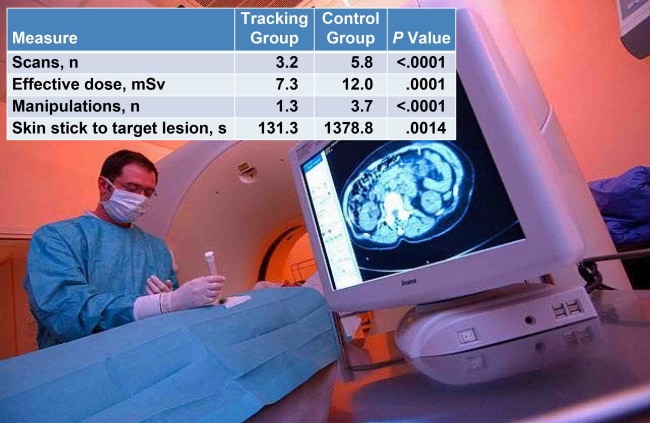 Ct Guided Liver Biopsy Recovery Time