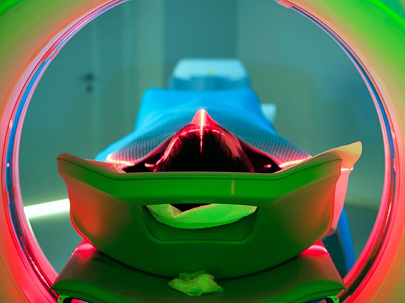 Model May Predict Post-treatment Hodgkin Lymphoma Outcomes