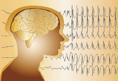 Cardiovascular Biomarkers In Acute Kawasaki Disease Cardiovascular Biomarkers In Acute Kawasaki Disease