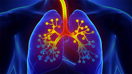 Clinical Advances in Key Issues in the Diagnosis, Referral and Therapy of Severe Asthma