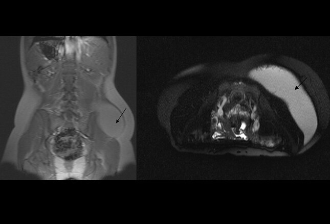 Blunt injury abdomen dissertation