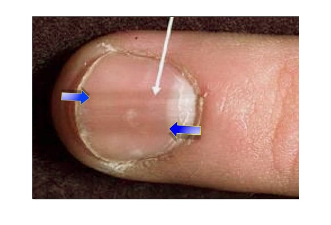Kidney troubles pores and skin situations