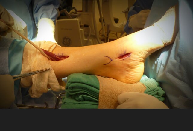 Slide 9.