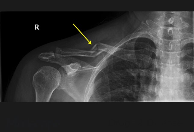 Slide 16.