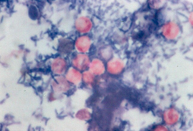 Common Intestinal Parasites: Slideshow