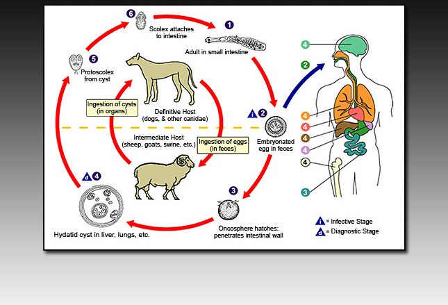 Common Intestinal Parasites: Slideshow