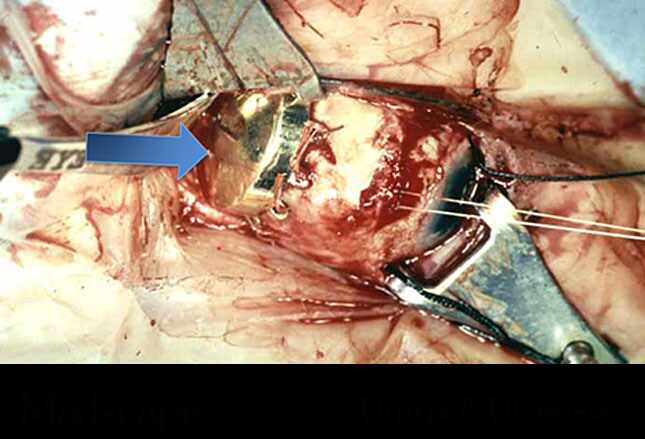 Slide 6.
