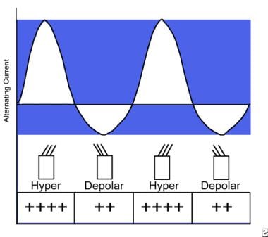 An illustration of the degrees of depolarization a