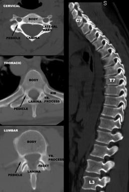 Comparison of vertebral anatomy in cervical, thora