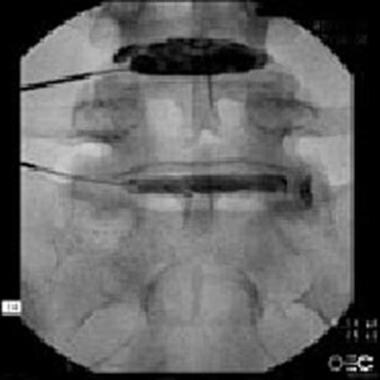 Anteroposterior view. 