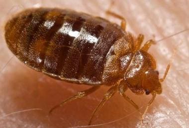 Bedbugs are parasitic arthropods from the family C