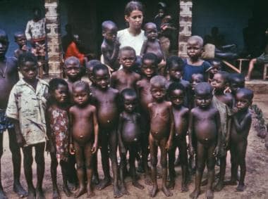 This photograph shows children and a nurse attenda