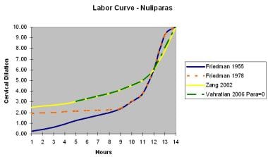 Labor curve for nulliparas. 