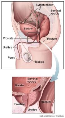 Prostate is small gland, about size and shape of w