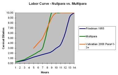 Labor curve for nulliparas versus multiparas. 