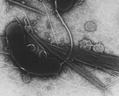 Electron microscopic image of Vibrio cholera. 