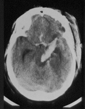 A CT scan of a young female who presented to the e