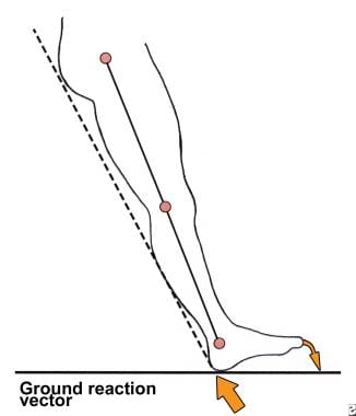 Diagram of ground reaction vector during heel stri