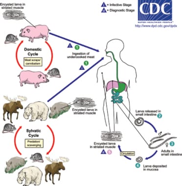 Trichinellosis is acquired by ingesting meat conta