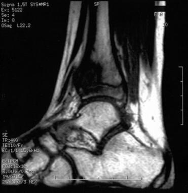 Sagittal T1-weighted (time echo = 10 ms, time repe