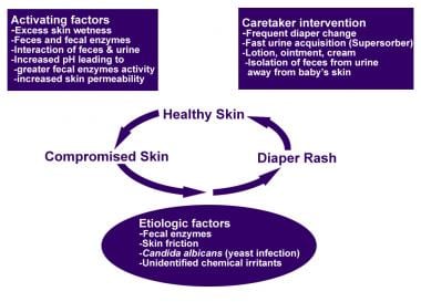 Diaper rash pathophysiology scheme. 