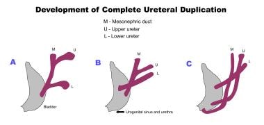 Line diagram shows development of complete uretera